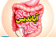 آپاندیس