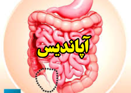 آپاندیس